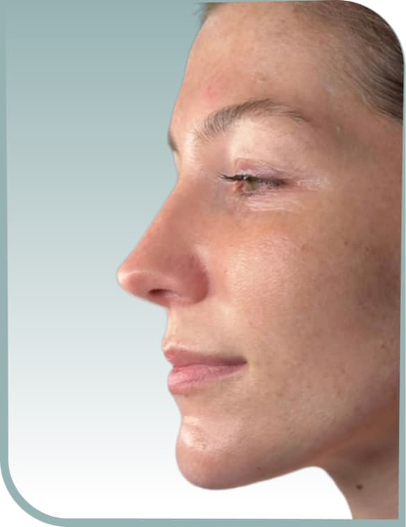 Hydration and even tone, Before photo (result 4 of 10)