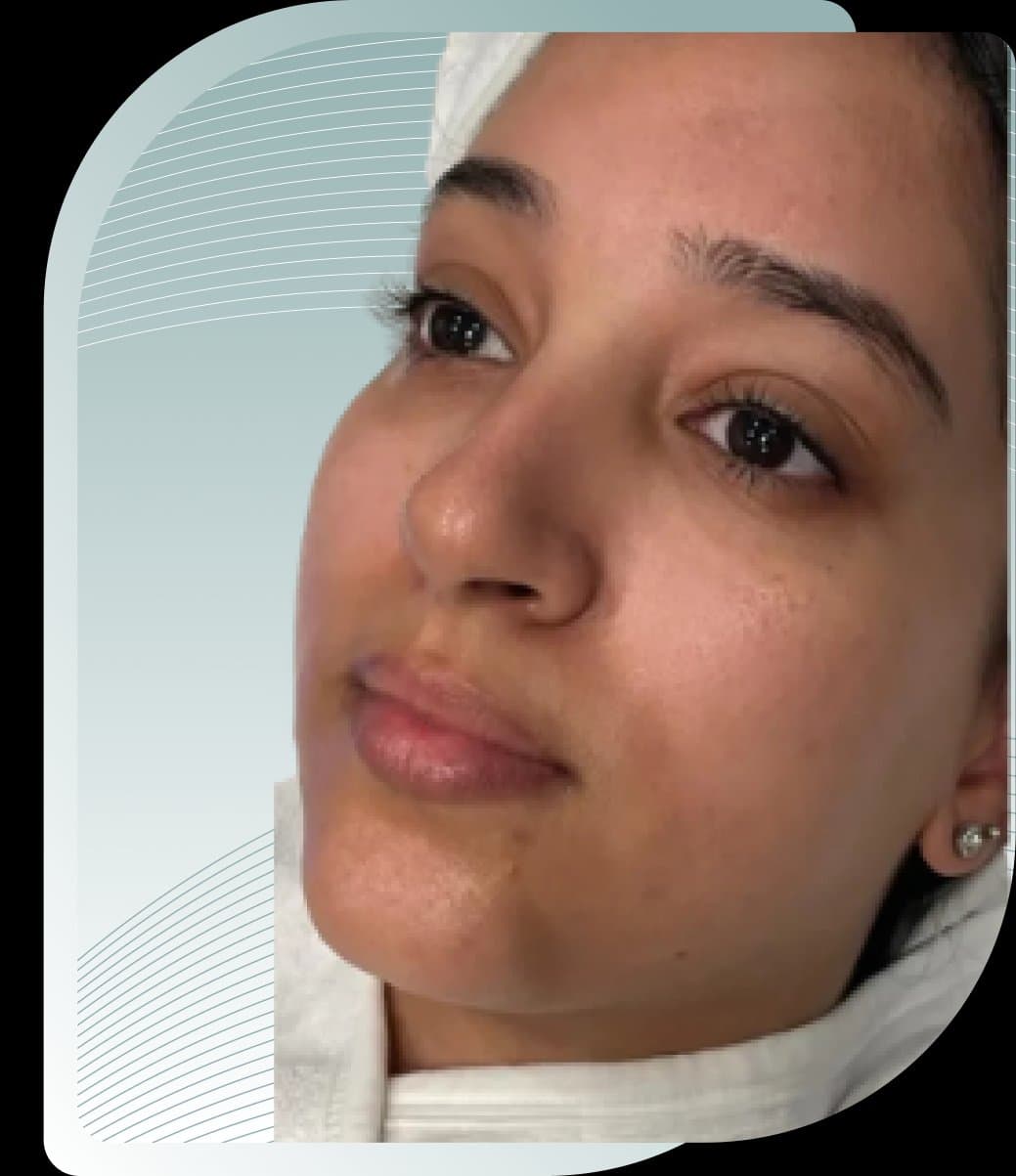Radiance and hydration, Before photo (result 10 of 10)