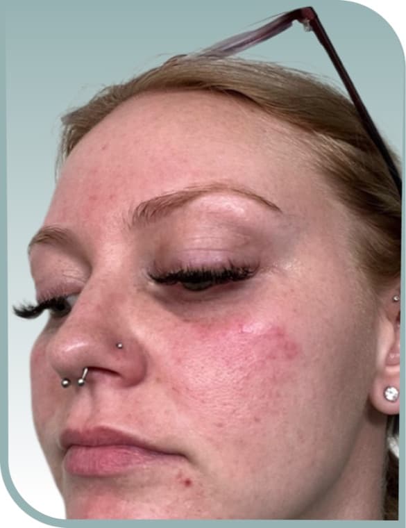 Fresh, dewy finish, Before photo (result 9 of 10)