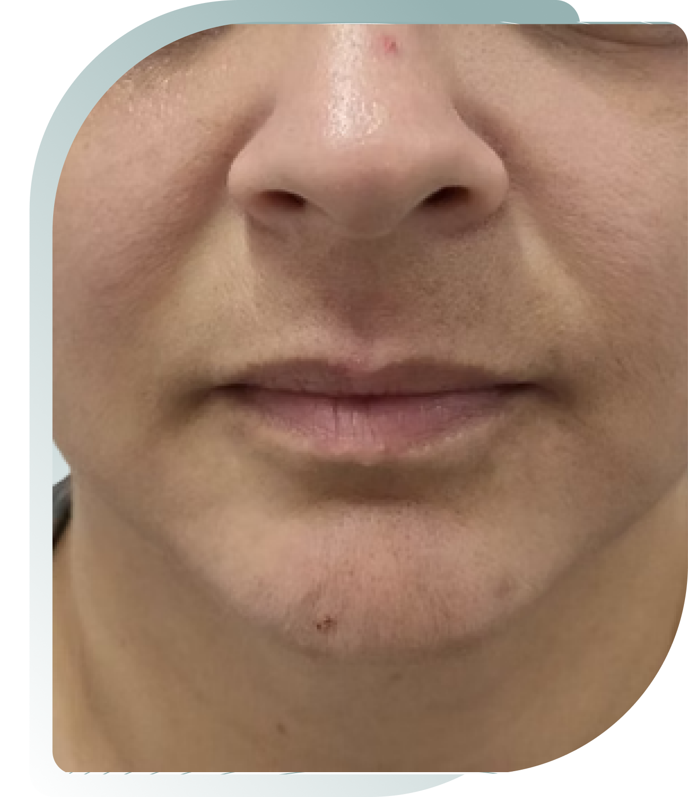 Natural Enhancement — Before photo (result 1 of 5)