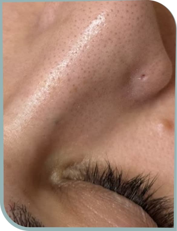 Pore refinement, Before photo (result 10 of 10)