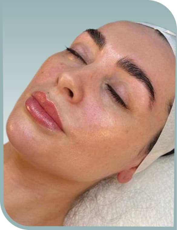 Dull dehydrated skin, Before photo (result 7 of 10)