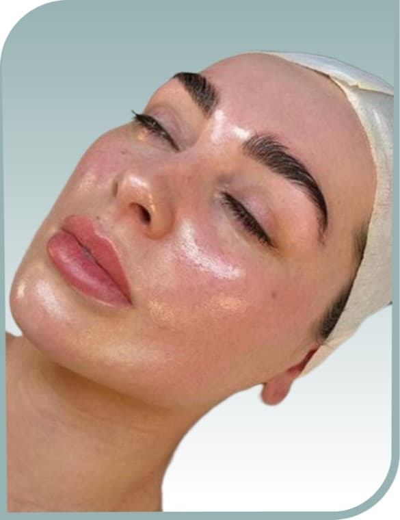 Dull dehydrated skin, After photo (result 7 of 10)