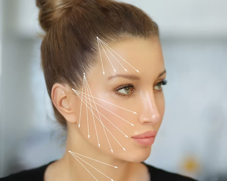 Thread lift treatment at Carisma Aesthetics Malta