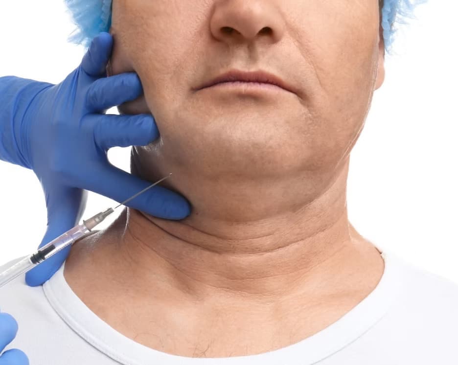 Fat dissolving treatment at Carisma Aesthetics Malta