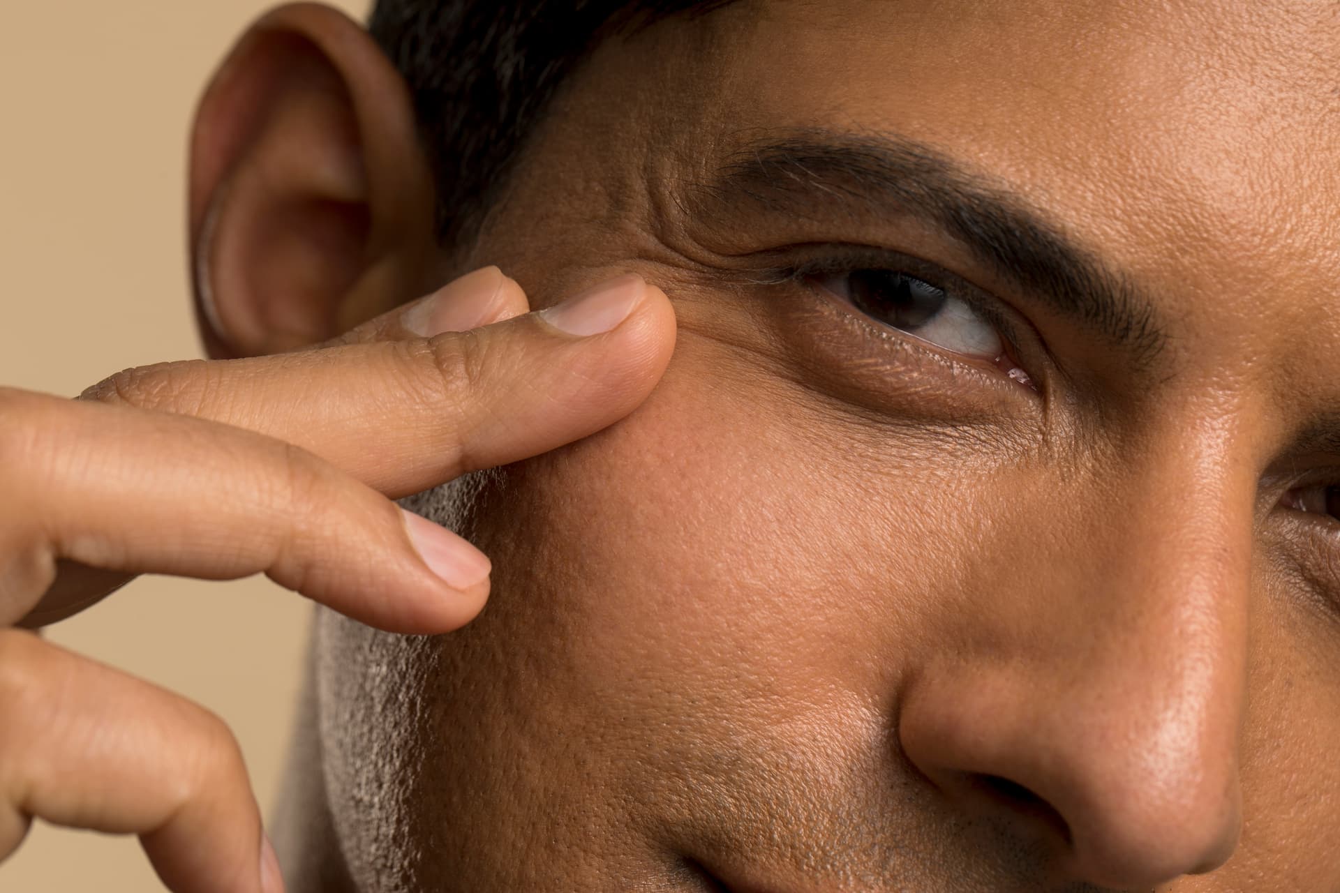 Tear Trough Filler in Malta: Erase Years of Under-Eye Tiredness