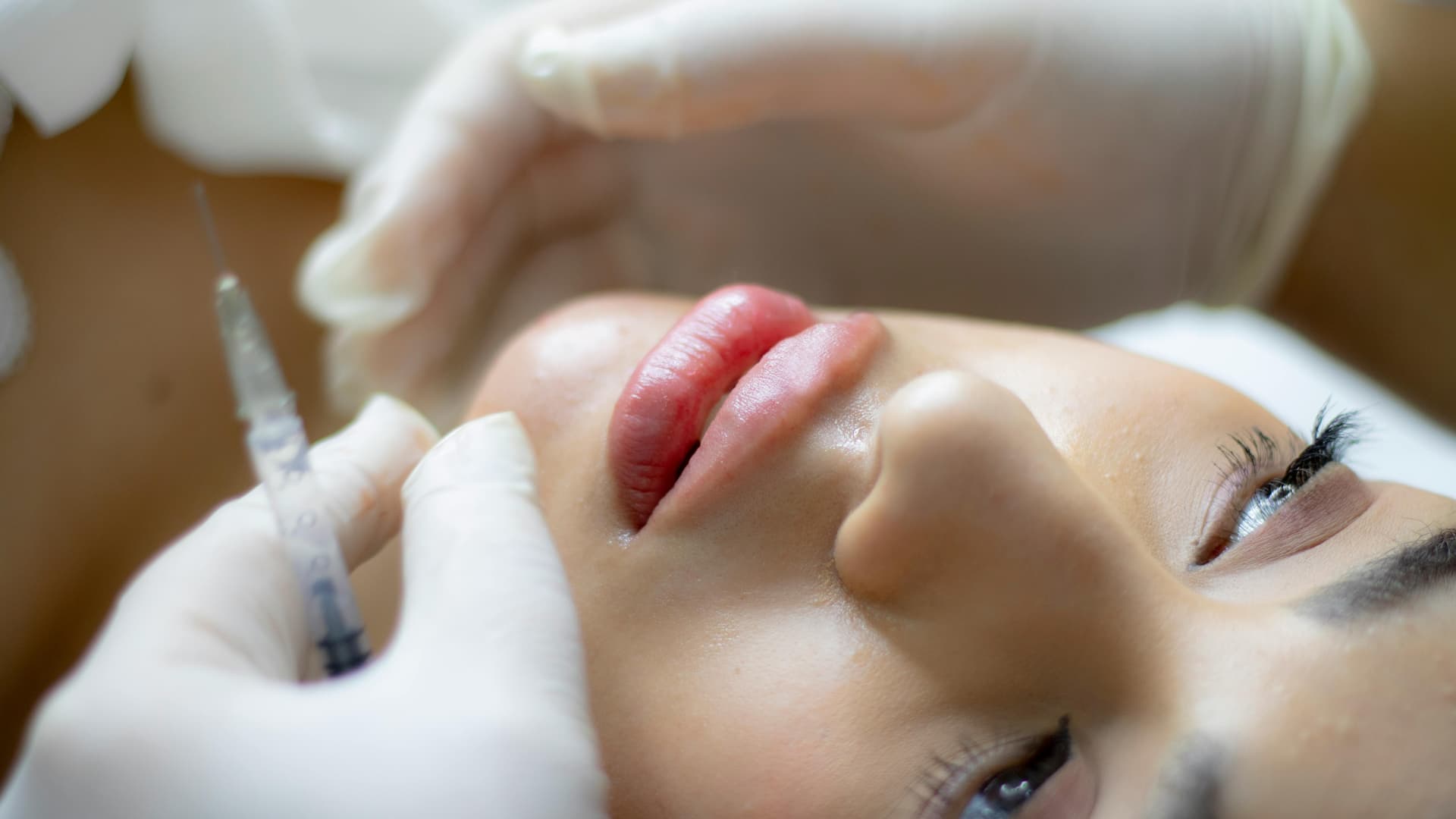 Russian Lips: Lifted. Defined. Effortlessly Elegant.